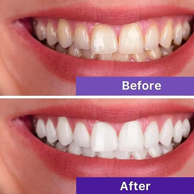 Purple Toothpaste for Teeth Whitening - Premium Whitener, Non-Abrasive, Color Corrector - Tooth Stain Removal, Teeth Whitening Kit, Whitening Toothpaste for Adults