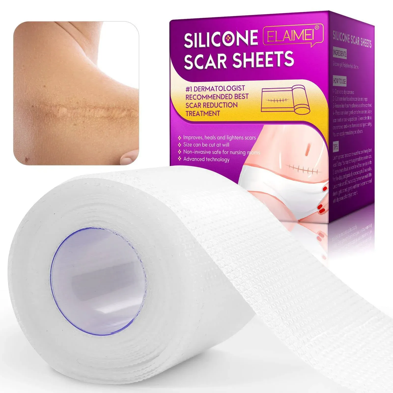 Silicone Scar Sheets, 1.6x60 inches, Away Upgrade... 